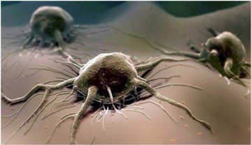 Трихомонада trihomonada 1